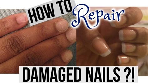 Nail Repair Service